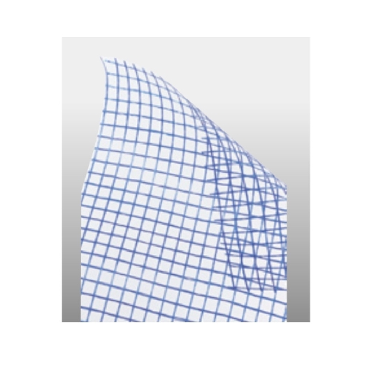 Rete in fibra di vetro da 1 metro Mapenet EM 40 Mapei -3